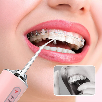 Irrigador Dental Limpieza Oral Recargable