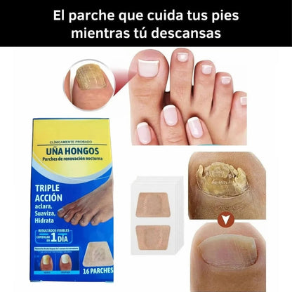 16 Parches Anti Hongos - Recupera y tus Uñas